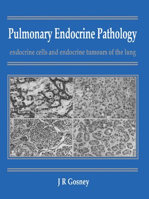 cover image of Pulmonary Endocrine Pathology